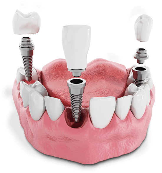 Oral Surgery Foster Ave Chicago