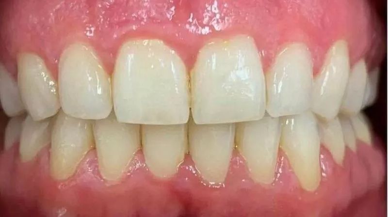 AFTER-INVI-compressed